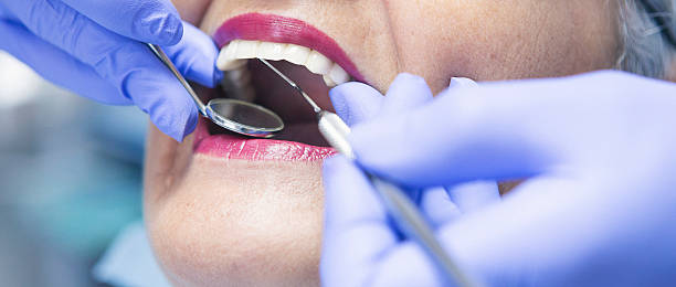 Best Emergency Dentist for Lost Fillings or Crowns in North Aurora, IL